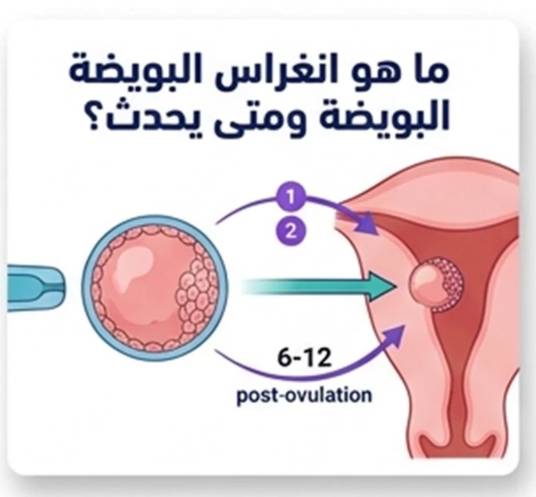 ما هو انغراس البويضة ومتى يحدث؟